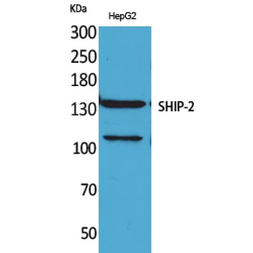 Polyclonal Rabbit anti-Human INPPL1 / SHIP2 Antibody (Internal, WB)