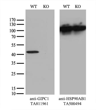 Monoclonal Mouse anti-Human GIPC1 / GIPC Antibody (clone OTI5C10, IHC, WB)