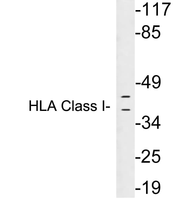 HLA-A/B/C Antibody (aa204-253)