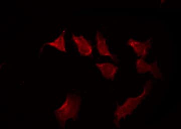 STAT3 Antibody (phospho-Ser727)