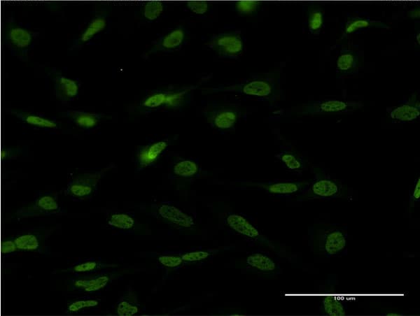 Monoclonal Mouse anti-Human HIF2A / EPAS1 Antibody (clone 1G2, IF, WB)
