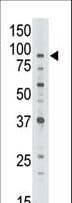 Polyclonal Rabbit anti-Human ABCB7 Antibody (aa718-746, IHC, WB)