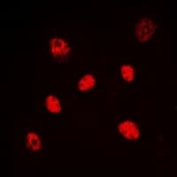 HNF4 Alpha+Gamma Antibody (Internal)