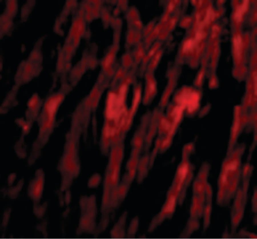IHC-plus™ Polyclonal Rabbit anti-Human BAP29 / BCAP29 Antibody (IHC, IF, WB)