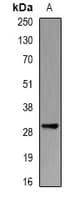 Polyclonal Rabbit anti-Human PSMB10 Antibody (IHC, IF, WB)