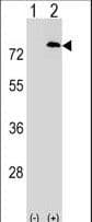 Polyclonal Rabbit anti-Human PD2 / PAF1 Antibody (aa439-467, WB)