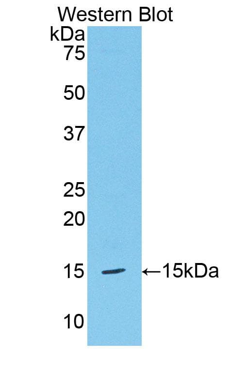 HPSE / Heparanase Antibody (aa419-535)