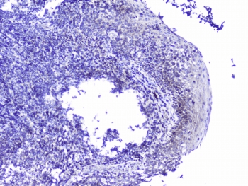 Polyclonal Rabbit anti-Human CDK6 Antibody (IHC, WB)