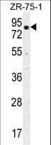 Polyclonal Rabbit anti-Human BTRCP / BETA-TRCP Antibody (aa17-52, IHC, IF, WB)