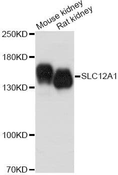 SLC12A1 / NKCC2 Antibody