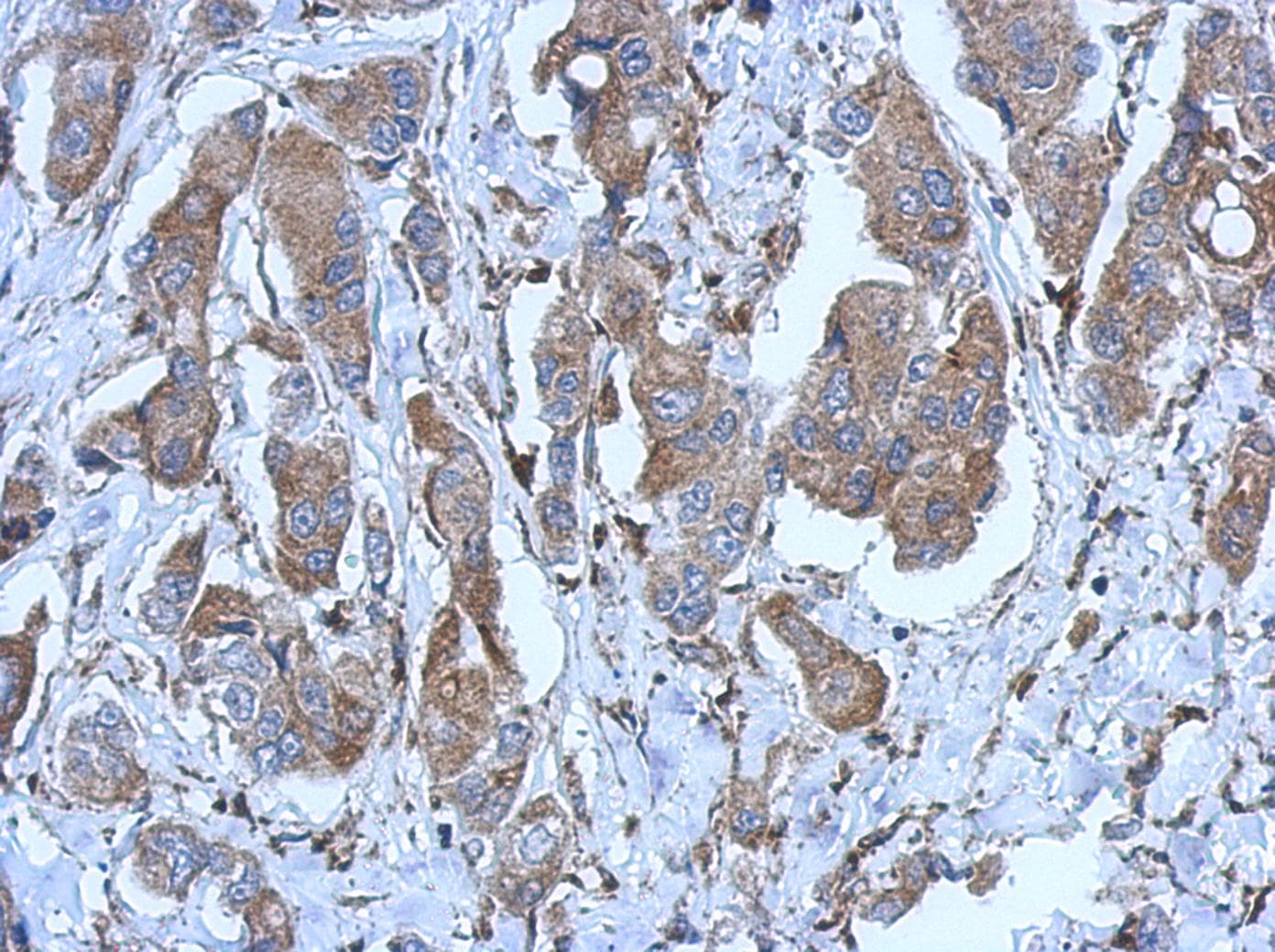 P2RX2 / P2X2 Antibody