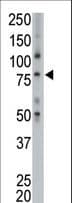 Polyclonal Rabbit anti-Human TPX2 Antibody (aa350-382, IHC, WB)