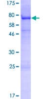 Human VSIG1 Protein (Recombinant GST)