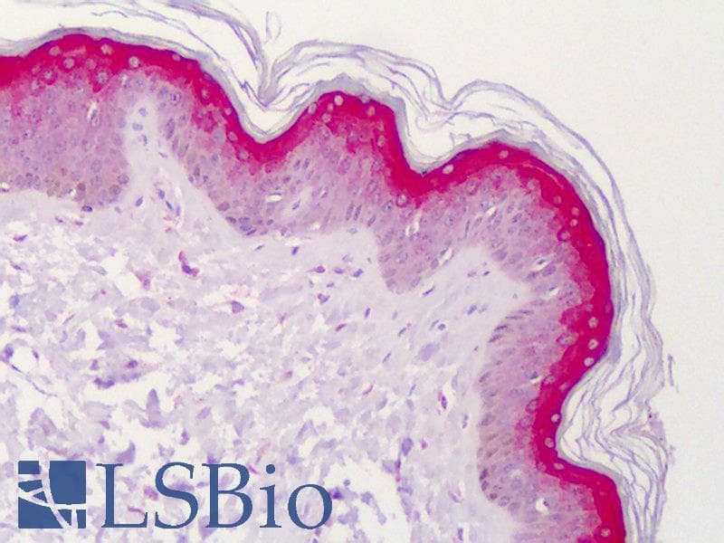 IHC-plus™ STEAP4 Antibody (aa201-250)