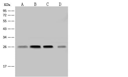 Polyclonal Rabbit anti-Human NDUFV2 Antibody (WB)