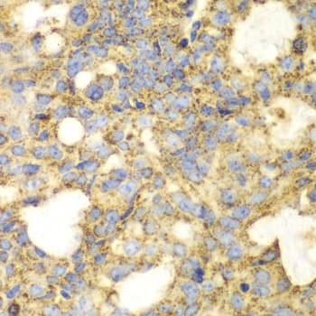 SOD2 / Mn SOD Antibody