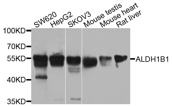ALDH1B1 Antibody