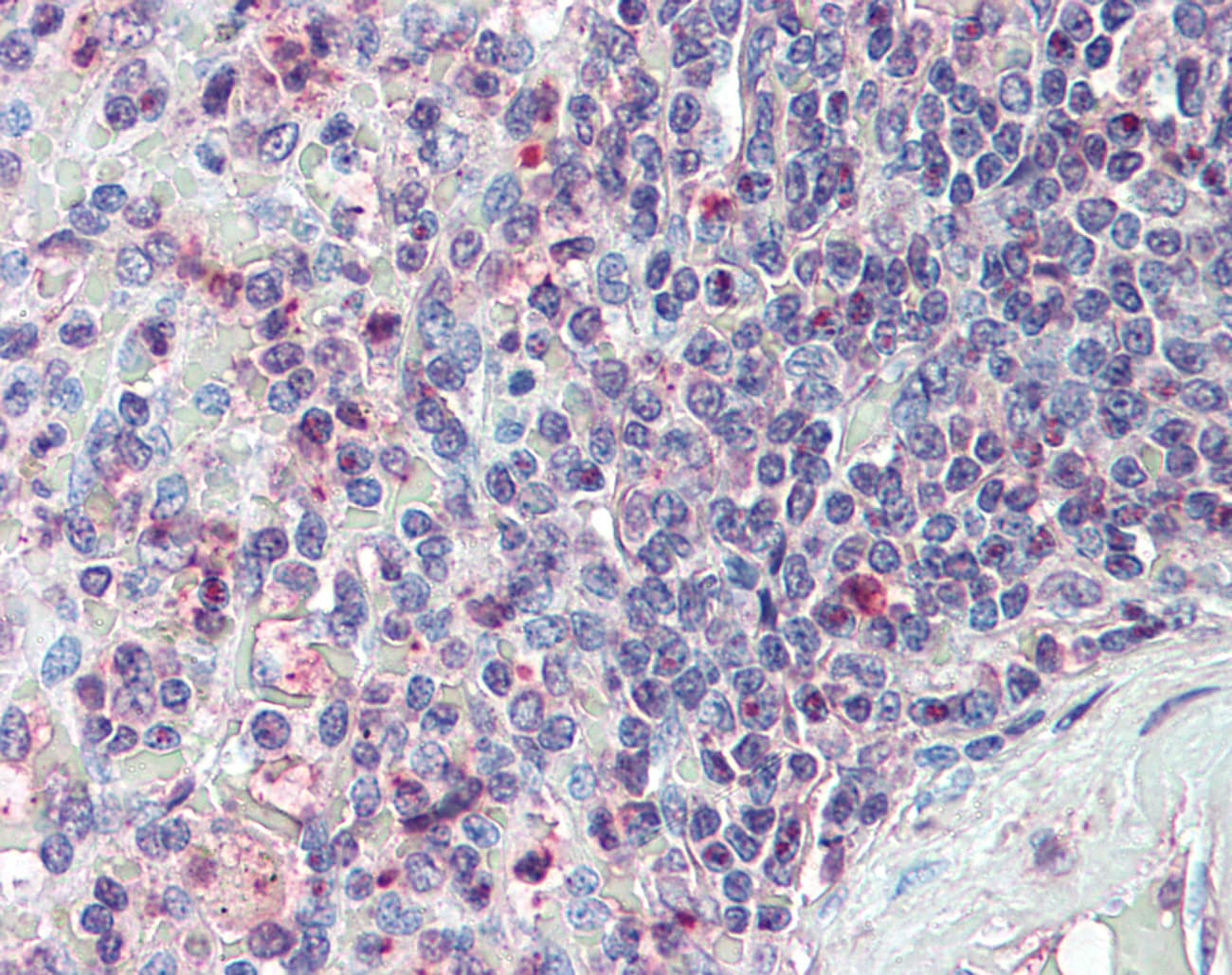 IHC-plus™ CD27L / CD70 Antibody (N-Terminus)