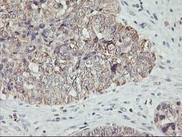 AGPAT5 Antibody (clone OTI1D4)