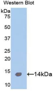 Calgizzarin / S100A11 Antibody (aa1-105, FITC)