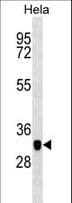 CAPG Antibody (aa181-209)