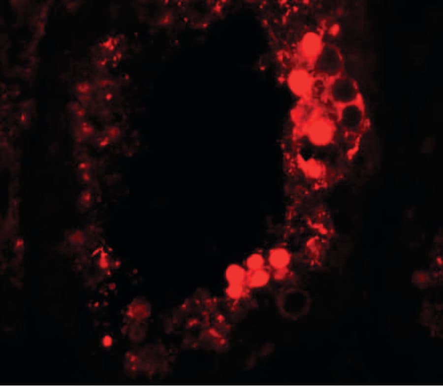 IHC-plus™ Polyclonal Rabbit anti-Human ESX1 Antibody (IHC, IF, WB)