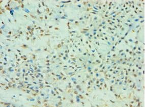 TDP1 Antibody (aa1-260)