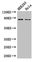 Polyclonal Rabbit anti-Human MLH1 Antibody (IHC, IF, WB)