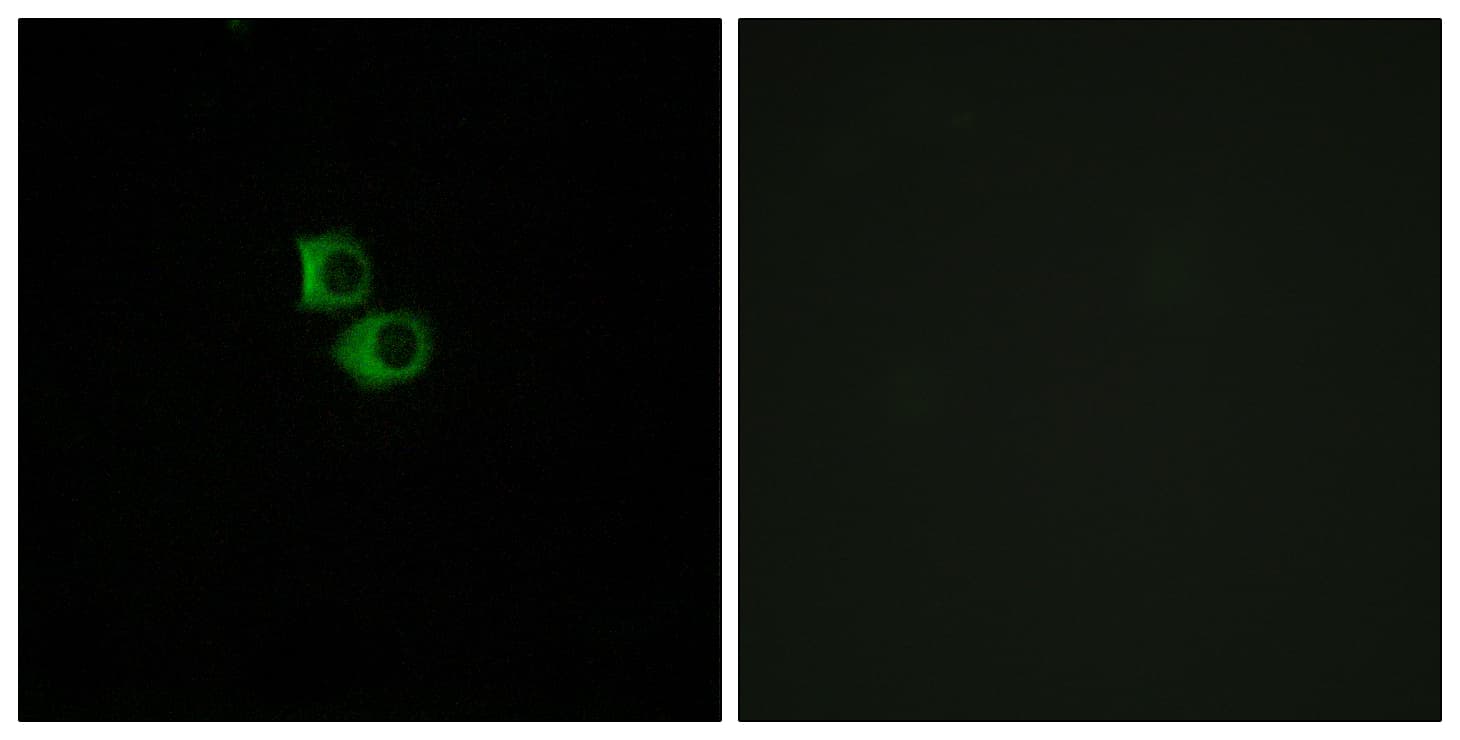 OR51B6 Antibody (aa66-115)