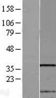 Human FAM192A / Nip30 Protein (Over-Expression Lysate Myc-DDK (Flag))