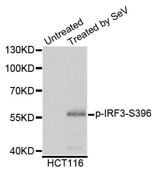 IRF3 Antibody (phospho-Ser396)