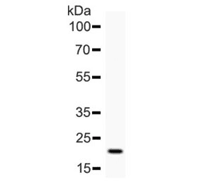 Polyclonal Rabbit anti-Human IL6 / Interleukin 6 Antibody (aa29-212, WB)