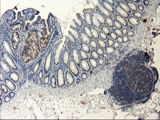 GPR49 / LGR5 Antibody (aa250-550, clone OTI2A2)