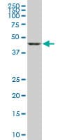 Monoclonal Mouse anti-Human GSDMB / Gasdermin-Like Antibody (clone 1E10, WB)