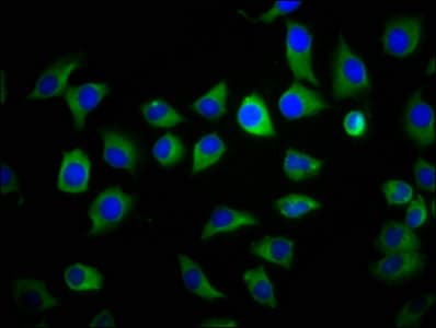 IHC-plus™ S100A9 / MRP14 Antibody