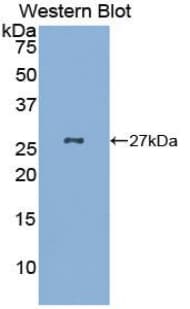 GKN2 / Gastrokine 2 Antibody (aa21-184)