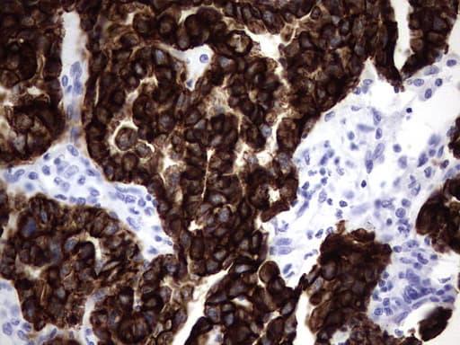 Monoclonal Mouse anti-Human KRT19 / CK19 / Cytokeratin 19 Antibody (clone OTI1E7, aa240-390, IHC)
