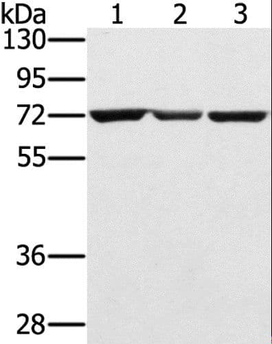 Polyclonal Rabbit anti-Human SLC25A13 / CITRIN Antibody (IHC, WB)