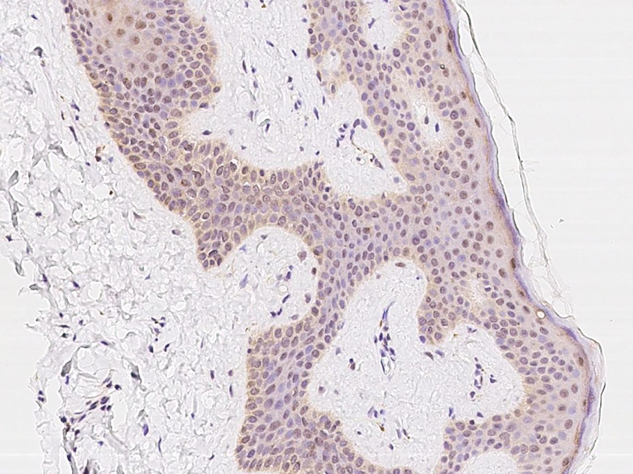 RNGTT / HCAP Antibody