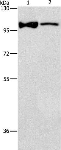 ADCY3 / Adenylate Cyclase 3 Antibody (aa855-1144)