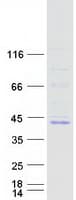 Human FOXB1 Protein (Recombinant Myc-DDK (Flag))