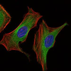 IGF2 Antibody (Amino Acid: 25-180, clone 8H1)
