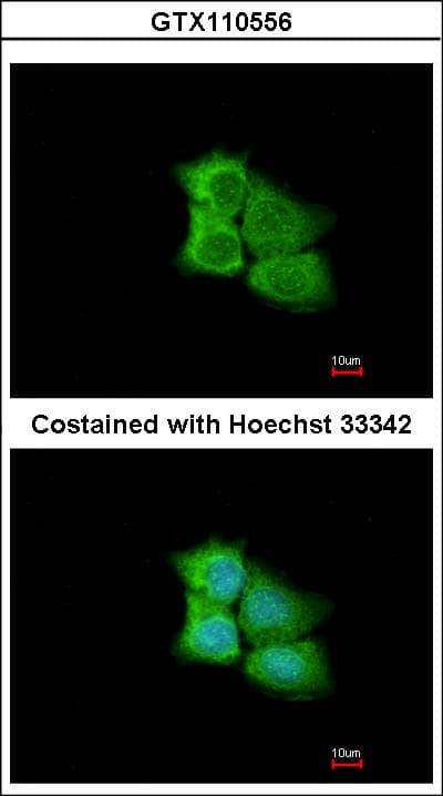 IHC-plus™ Polyclonal Rabbit anti-Human PCMT1 Antibody (aa10-227, IHC, WB)