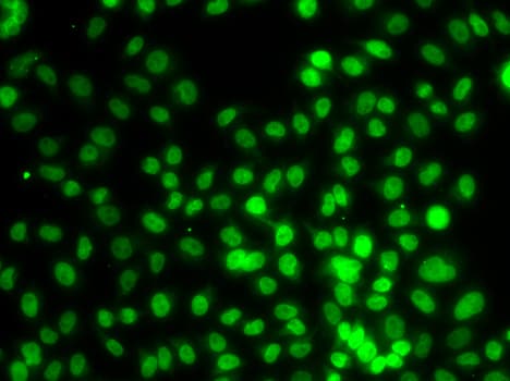 IHC-plus™ SETD8 / SET8 Antibody