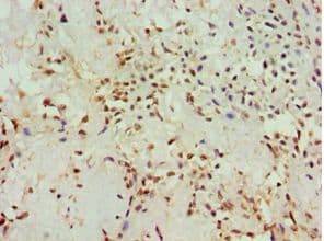 LBC / AKAP13 Antibody (aa1-150)