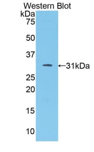 F5 / Factor Va Antibody (aa463-715)