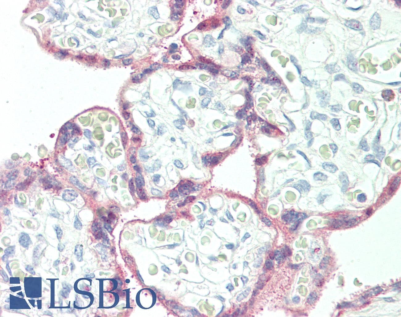 IHC-plus™ SERPINB2 / PAI-2 Antibody (Internal)