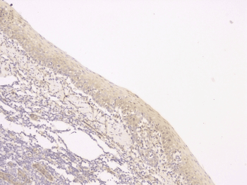SRCIN1 / SNIP Antibody