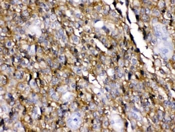 SLC1A3 / EAAT1 Antibody