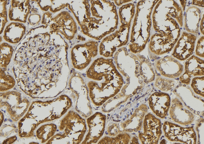 Polyclonal Rabbit anti-Human SEMA3A / Semaphorin 3A Antibody (IHC, WB)
